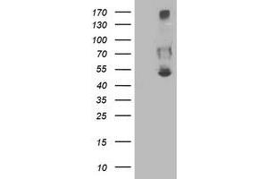 Western Blotting (WB) image for anti-Sedoheptulokinase (SHPK) antibody (ABIN1500923) (SHPK Antikörper)