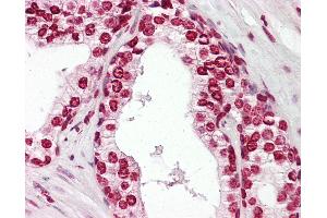 Anti-MKX antibody IHC of human prostate. (MKX Antikörper  (AA 191-240))