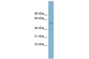 WB Suggested Anti-SUSD4 Antibody Titration:  0. (SUSD4 Antikörper  (Middle Region))
