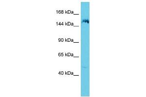 Host: Rabbit Target Name: ANKRD36B Sample Type: 721_B Whole Cell lysates Antibody Dilution: 1. (ANKRD36B Antikörper  (C-Term))