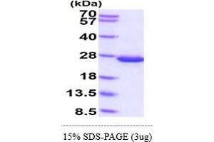 SDS-PAGE (SDS) image for Diazepam Binding Inhibitor (DBI) (AA 1-87) protein (His tag) (ABIN5855101)