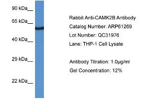 Western Blotting (WB) image for anti-Calcium/calmodulin-Dependent Protein Kinase II beta (CAMK2B) (Middle Region) antibody (ABIN786379) (CAMK2B Antikörper  (Middle Region))