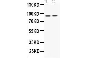 Western blot analysis of UHRF1 expression in MCF-7 whole cell lysates ( Lane 1) and U2OS whole cell lysates ( Lane 2).