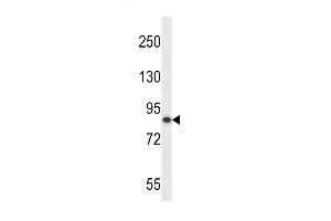 Western blot analysis in MDA-MB453 cell line lysates (35ug/lane). (OTUD7B Antikörper  (C-Term))