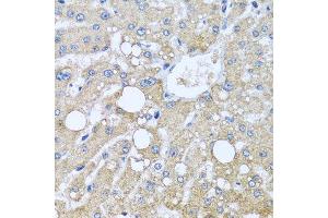 Immunohistochemistry of paraffin-embedded human liver injury using TUBGCP3 antibody. (TUBGCP3 Antikörper  (AA 1-250))