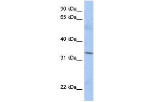 WB Suggested Anti-MRPL15 Antibody Titration:  0. (MRPL15 Antikörper  (N-Term))