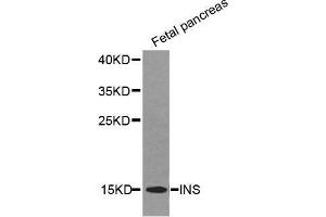 Western Blotting (WB) image for anti-Insulin (INS) (AA 1-110) antibody (ABIN3022885) (Insulin Antikörper  (AA 1-110))