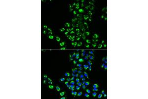 Immunofluorescence analysis of A549 cells using EIF5B antibody. (EIF5B Antikörper)