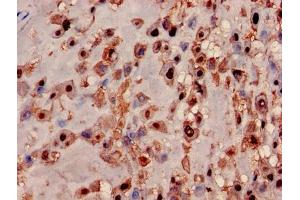 Immunohistochemistry of paraffin-embedded human placenta tissue using ABIN7142365 at dilution of 1:100 (MRPL19 Antikörper  (AA 1-292))