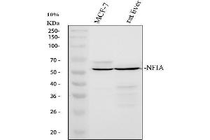Western blot analysis of NFIA using anti-NFIA antibody (ABIN4886680). (NFIA Antikörper  (Middle Region))