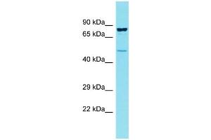 Host: Rabbit Target Name: CCDC121 Sample Type: OVCAR-3 Whole Cell lysates Antibody Dilution: 1. (CCDC121 Antikörper  (Middle Region))
