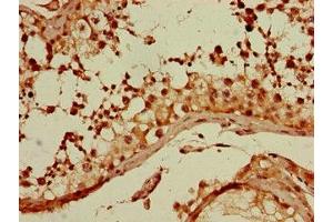 Immunohistochemistry of paraffin-embedded human testis tissue using ABIN7154727 at dilution of 1:100 (GNA11 Antikörper  (AA 1-359))
