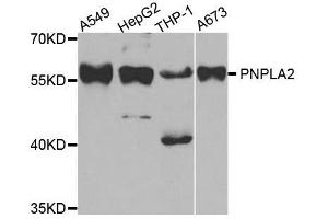 Western blot analysis of extracts of various cell lines, using PNPLA2 antibody. (PNPLA2 Antikörper  (AA 265-504))