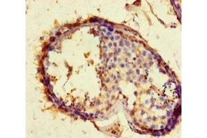 Immunohistochemistry of paraffin-embedded human testis tissue using ABIN7144126 at dilution of 1:100 (ACE2 Antikörper  (AA 395-638))