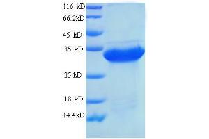 Urate Oxidase Protein (UOX) (AA 11-297) (His tag)