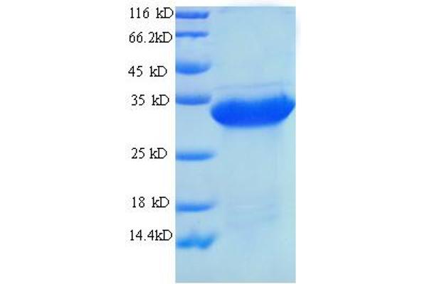 Urate Oxidase Protein (UOX) (AA 11-297) (His tag)