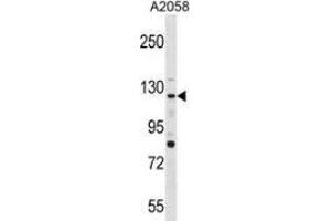 Western blot analysis in A2058 cell line lysates (35ug/lane) using PTPRN2  Antibody . (PTPRN2 Antikörper  (N-Term))