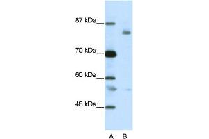 WB Suggested Anti-LZTR1 Antibody Titration:  2. (LZTR1 Antikörper  (C-Term))