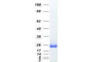 Western Blotting (WB) image for Ras Homolog Gene Family, Member B (RHOB) protein (Myc-DYKDDDDK Tag) (ABIN2730845)