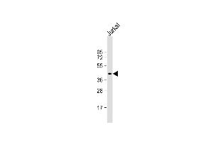 Anti-PIM1 Antibody  at 1:1000 dilution + Jurkat whole cell lysate Lysates/proteins at 20 μg per lane. (PIM1 Antikörper  (C-Term))