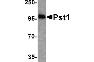 Western blot analysis of TM yeast Pst1 protein (50 ng) with Pst1 antibody at 1 µg/mL.