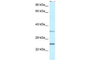 Western Blot showing PPP1R2 antibody used at a concentration of 1 ug/ml against THP-1 Cell Lysate