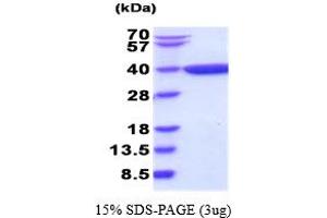 SDS-PAGE (SDS) image for Dihydrodiol Dehydrogenase (DDH) (AA 1-323) (Active) protein (ABIN5854480) (AKR1C1 Protein (AA 1-323))