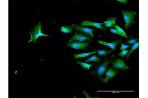 Immunofluorescence of purified MaxPab antibody to CD44 on HeLa cell. (CD44 Antikörper  (AA 1-361))