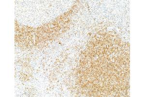 Immunohistochemistry (IHC) image for anti-B-cell antigen receptor complex-associated protein alpha chain (CD79A) (AA 176-226) antibody (ABIN7454005)