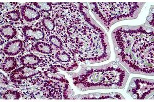 Human Small Intestine: Formalin-Fixed, Paraffin-Embedded (FFPE) (SMARCA4 Antikörper  (AA 2-14))