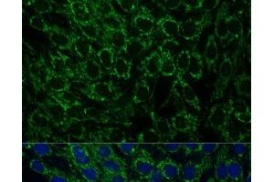 Immunofluorescence analysis of C6 cells using MTIF2 Polyclonal Antibody at dilution of 1:100 (40x lens). (MTIF2 Antikörper)