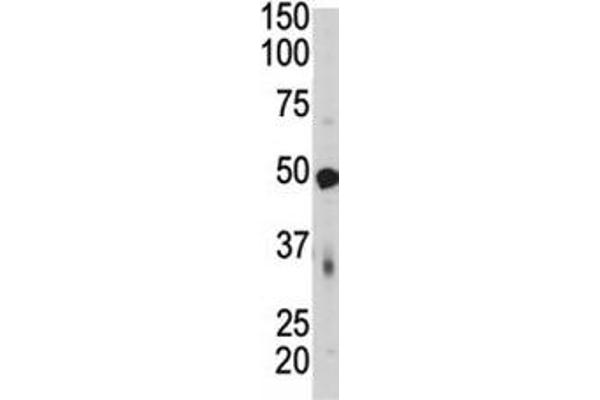 PDK4 antibody  (AA 382-410)