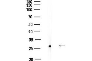Western blot analysis of lysates from Rat testis, using SLC25 Antibody at 1/1000 dilution.