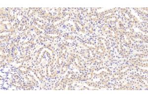 Immunohistochemistry (IHC) image for anti-Tumor Necrosis Factor (Ligand) Superfamily, Member 15 (TNFSF15) (AA 70-230) antibody (ABIN7442315)
