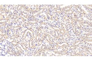 Detection of TL1A in Rat Kidney Tissue using Polyclonal Antibody to TNF Like Ligand 1A (TL1A) (TNF Like Ligand 1A (AA 70-230) Antikörper)