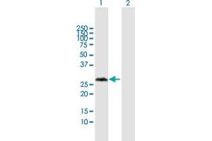 Western Blot analysis of VCX3A expression in transfected 293T cell line by VCX3A MaxPab polyclonal antibody. (VCX3A Antikörper  (AA 1-166))