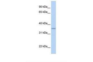 Image no. 1 for anti-Glyoxylate Reductase/hydroxypyruvate Reductase (GRHPR) (AA 38-87) antibody (ABIN6738447) (GRHPR Antikörper  (AA 38-87))