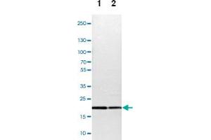 Western blot analysis of Lane 1: NIH-3T3 cell lysate (Mouse embryonic fibroblast cells), Lane 2: NBT-II cell lysate (Rat Wistar bladder tumour cells) with TOMM22 polyclonal antibody  at 1:100-1:500 dilution. (TOMM22 Antikörper)