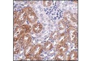 Immunohistochemistry of LIAR in mouse kidney tissue AP30506PU-N antibody at 2. (ANKRD54 Antikörper  (C-Term))