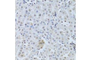 Immunohistochemistry of paraffin-embedded mouse kidney using CDK4 Antibody. (CDK4 Antikörper  (AA 1-303))