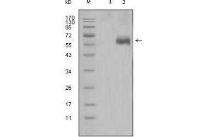 Western blot analysis using DKK1 mouse mAb against HEK293 (1) and DKK1-hIgGFc transfected HEK293 cell lysate (2). (DKK1 Antikörper)