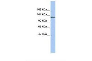 Image no. 1 for anti-SWI/SNF-Related, Matrix-Associated Actin-Dependent Regulator of Chromatin, Subfamily A, Containing DEAD/H Box 1 (SMARCAD1) (AA 218-267) antibody (ABIN6737754)
