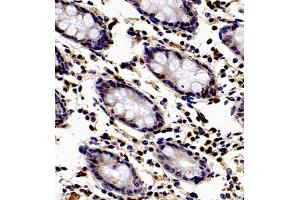 Immunohistochemistry (Paraffin-embedded Sections) (IHC (p)) image for anti-Apoptosis Inhibitor 5 (API5) antibody (ABIN7073094)