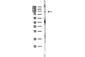 anti-Dimethylglycine Dehydrogenase (DMGDH) (C-Term) antibody