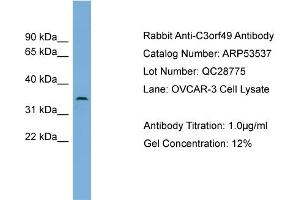 WB Suggested Anti-C3orf49  Antibody Titration: 0. (C3orf49 Antikörper  (Middle Region))
