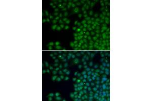 Immunofluorescence analysis of HeLa cells using NUDT6 antibody. (NUDT6 Antikörper)