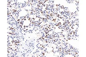Immunohistochemistry analysis of paraffin-embedded mouse inflammatory lung using MMP9 Monoclonal Antibody at dilution of 1:400.