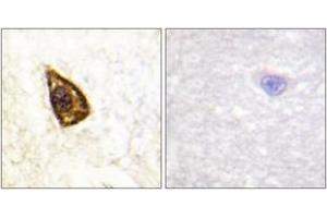 Immunohistochemistry analysis of paraffin-embedded human brain tissue, using Trk B (Ab-705) Antibody. (TRKB Antikörper  (AA 671-720))