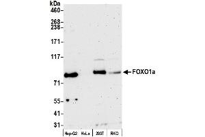 Western Blotting (WB) image for anti-Forkhead Box O1 (FOXO1) (C-Term) antibody (ABIN7450261)