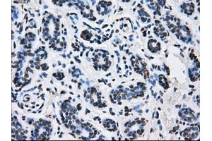 Immunohistochemical staining of paraffin-embedded breast tissue using anti-ID3 mouse monoclonal antibody. (ID3 Antikörper)
